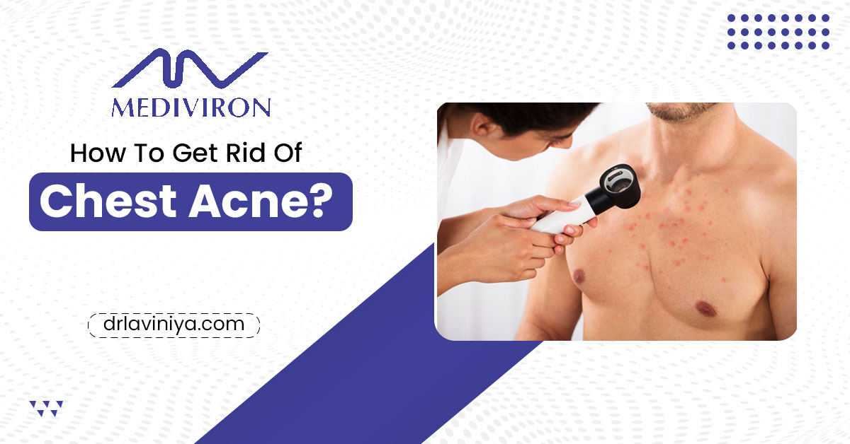 How to Get Rid of Chest Acne: A Comprehensive Guide