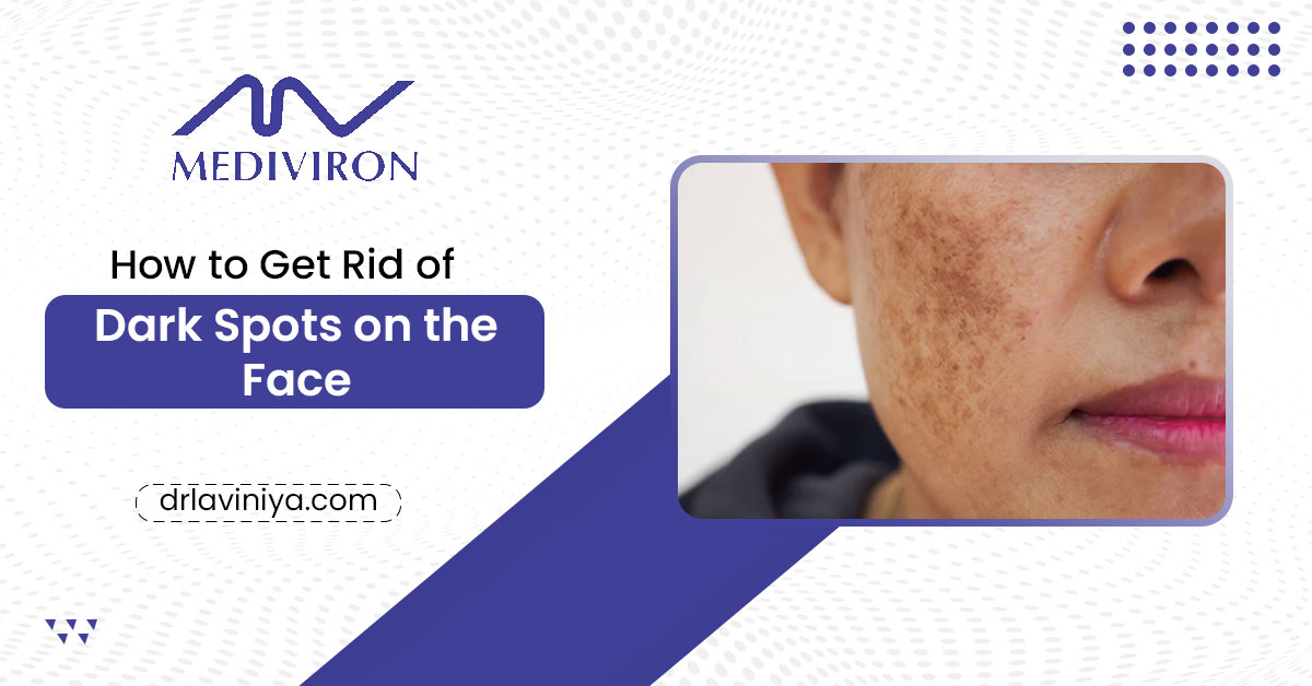 How to Get Rid of Dark Spots on the Face