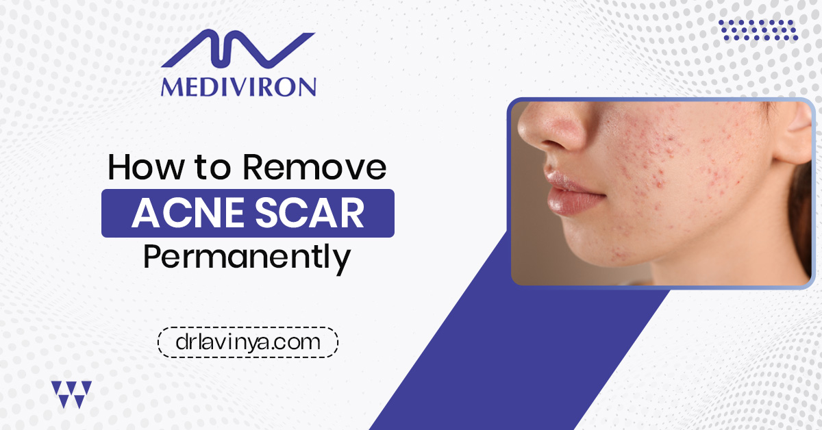 acne scars treatment in Malaysia