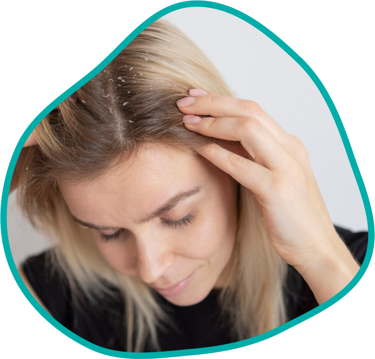 psoriasis-skin-clinic